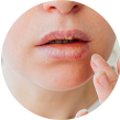 Dry mouth or skin