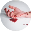 Severe bleeding
