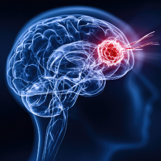 brain_tumor