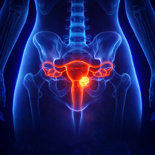 cervical_cancer